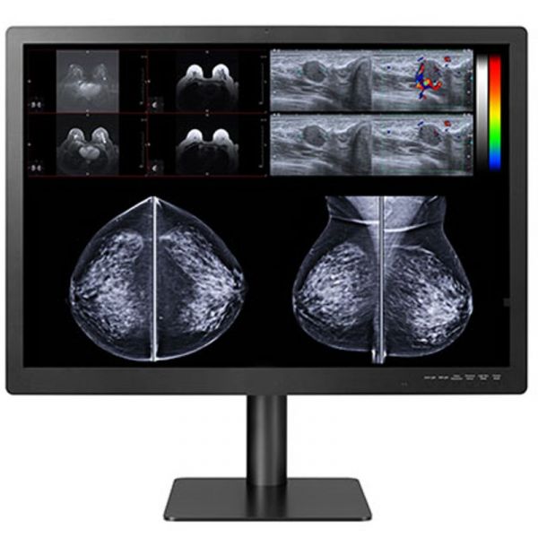 Double Black Imaging Gemini Series 12 MP Large Format Display