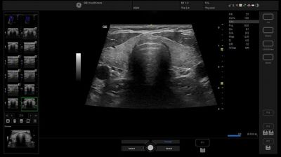 GE Healthcare Versana Premier