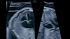 GE Healthcare Voluson E10