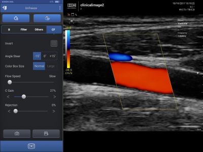 Healcerion Sonon 300L